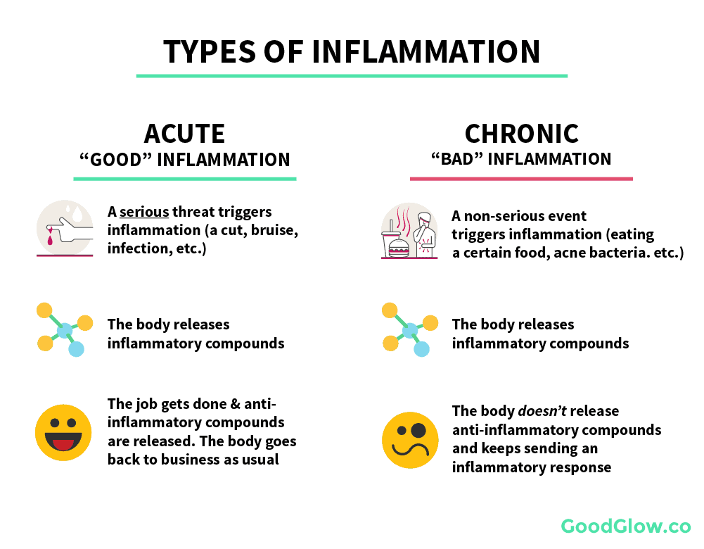 Acute inflammation versus chronic inflammation
