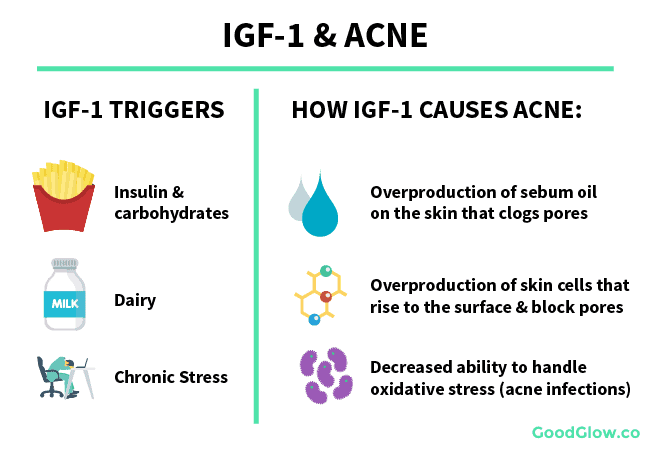IGF-1 triggers acne via increased sebum oil production, disrupted skin cell shedding, and oxidative damage. 