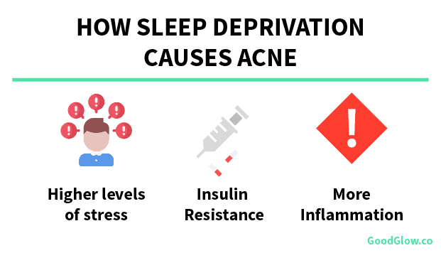 Sleep deprivation can cause acne