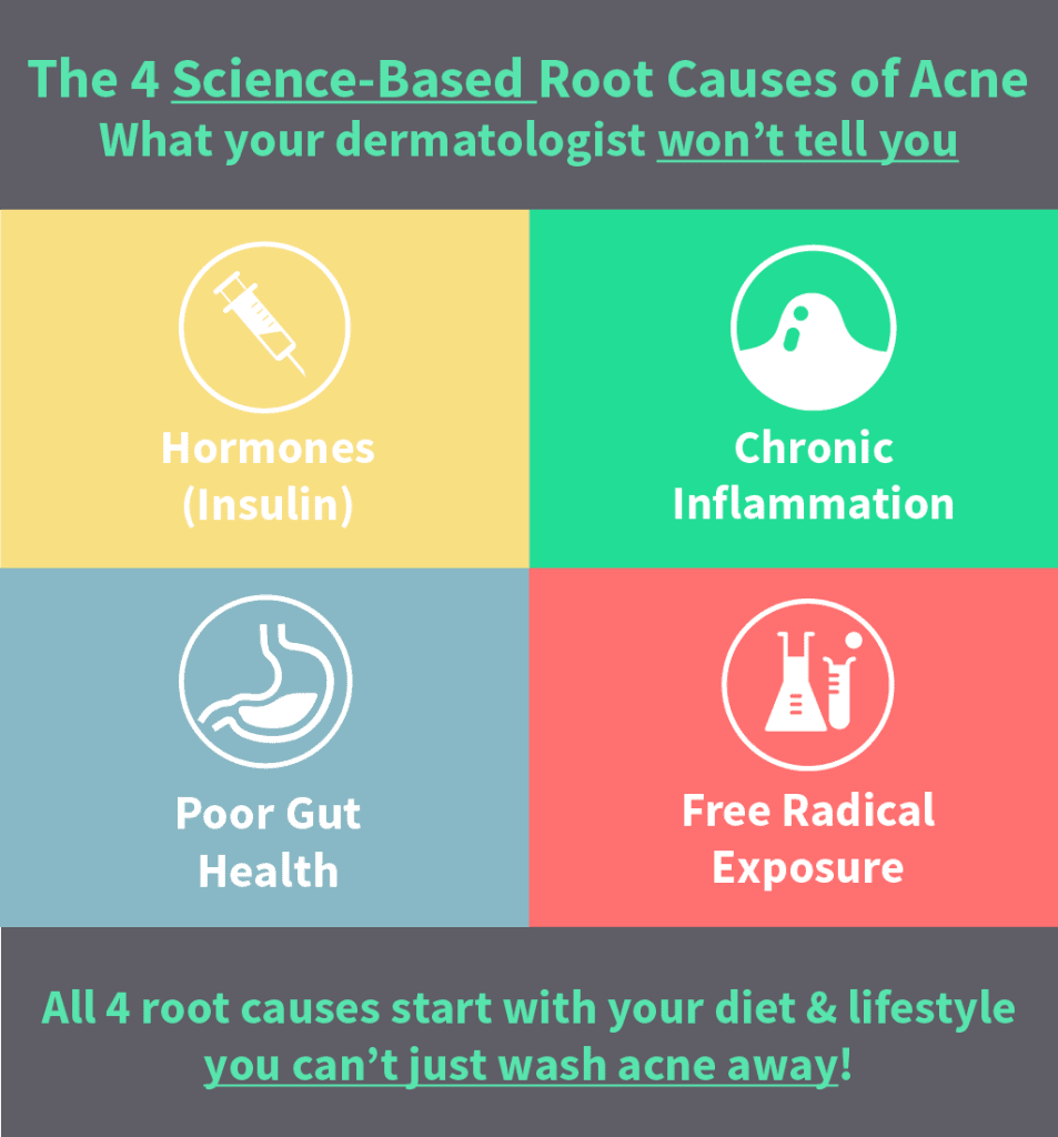 The 4 root causes of acne - hormones, chronic inflammation, poor gut health, free radical exposure