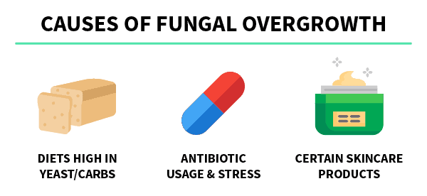 The causes of fungal overgrowth, fungal acne, and dandruff