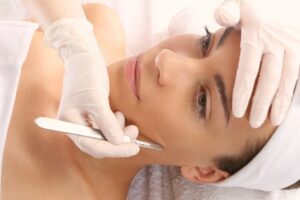 Is Dermaplaning Good For Acne