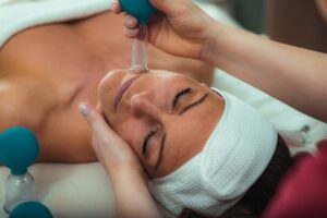 7 Reasons to Try Face Cupping For Acne Scars