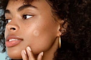 Best Pimple Patches for Acne - Good Glow