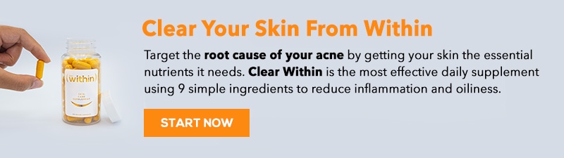 Clearwithin AD