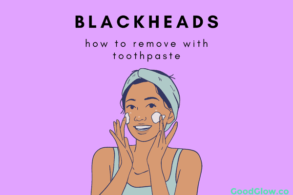 toothpaste on blackheads