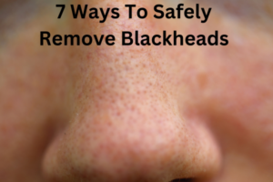 7 ways to remove blackheads