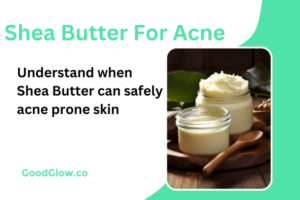 shea butter for acne