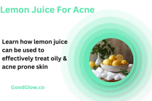 lemon juice acne